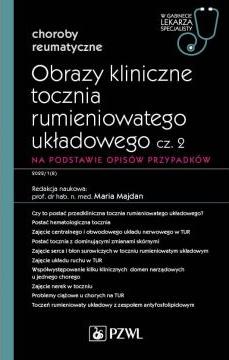 Obrazy kliniczne tocznia rumieniowatego układowego. Część 2. Na podstawie opisów przypadków. Choroby reumatyczne. W gabinecie lekarza specjalisty