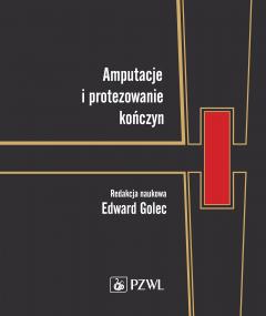 Amputacje i protezowanie kończyn