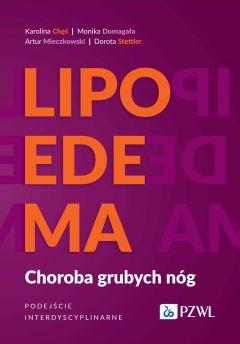 Lipoedema. Choroba grubych nóg. Podejście interdyscyplinarne