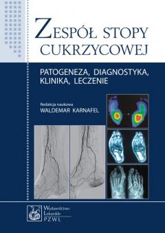 Zespół stopy cukrzycowej. Patogeneza, diagnostyka, klinika, leczenie