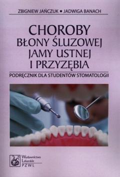 Choroby błony śluzowej jamy ustnej i przyzębia