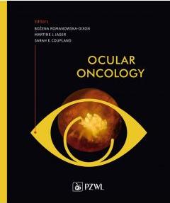 Ocular Oncology