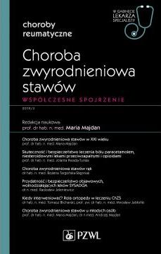 Choroba zwyrodnieniowa stawów. Współczesne spojrzenie. Choroby reumatyczne. W gabinecie lekarza specjalisty