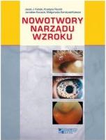 Nowotwory narządu wzroku