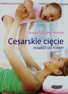 Cesarskie cięcie