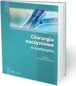 Chirurgia naczyniowa w medycynie