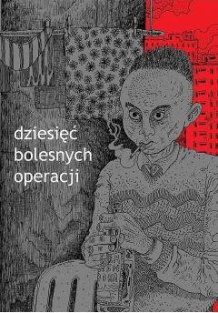 Dziesięć bolesnych operacji