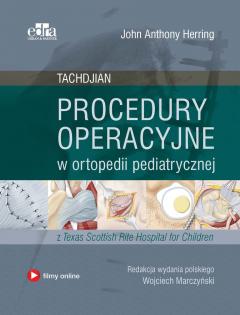 Procedury operacyjne w ortopedii pediatrycznej