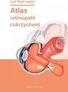 Atlas retinopatii cukrzycowej